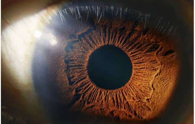 Robô-cirurgião consegue operar dentro de olho de paciente 20
